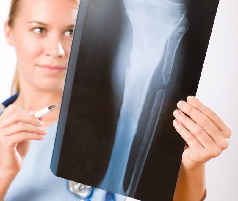 Daily Habits for Unmatched Comfort: Discover How to Support Joint Comfort Daily